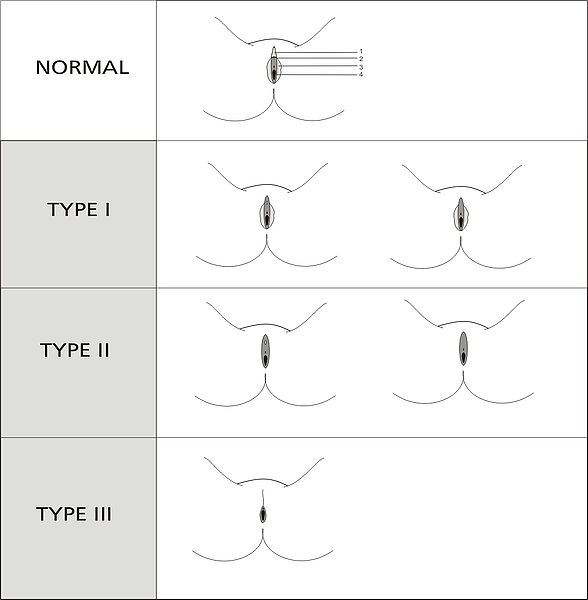 Various clitoris sizes